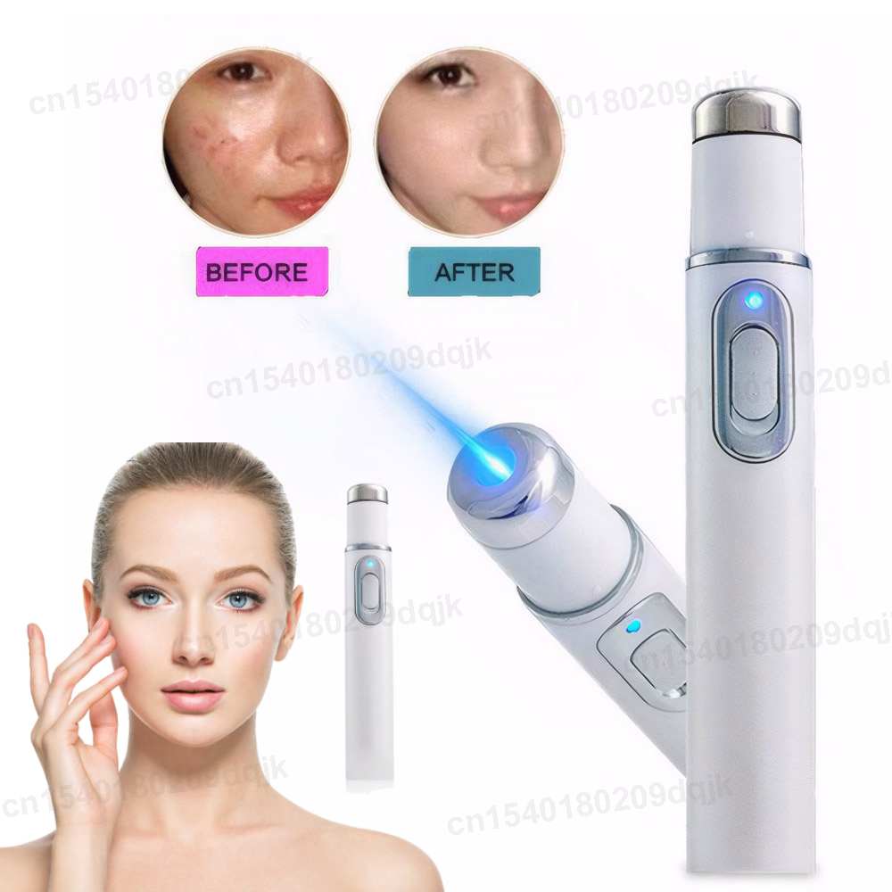 Stylo de thérapie à la lumière - Acne Light Therapy Pen avis et prix